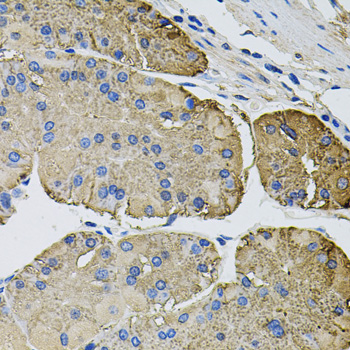 Immunohistochemistry - THBS2 Polyclonal Antibody 