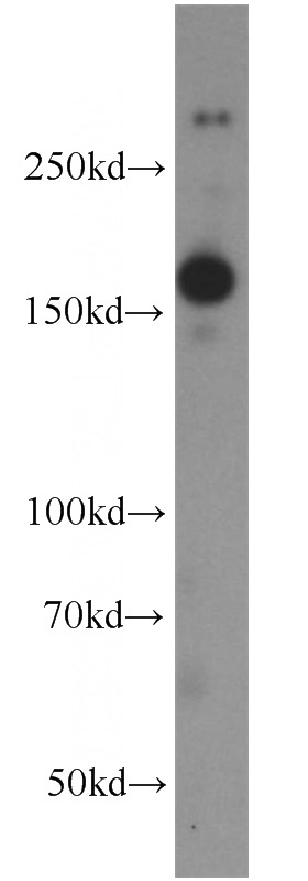 mouse brain tissue were subjected to SDS PAGE followed by western blot with Catalog No:113234(GRIN2B antibody) at dilution of 1:400