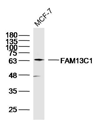 Fig2: Sample: MCF-7 Cell (Human) Lysate at 40 ug; Primary: Anti-FAM13C1 at 1/300 dilution; Secondary: IRDye800CW Goat Anti-Rabbit IgG at 1/20000 dilution; Predicted band size: 66 kD; Observed band size: 66 kD