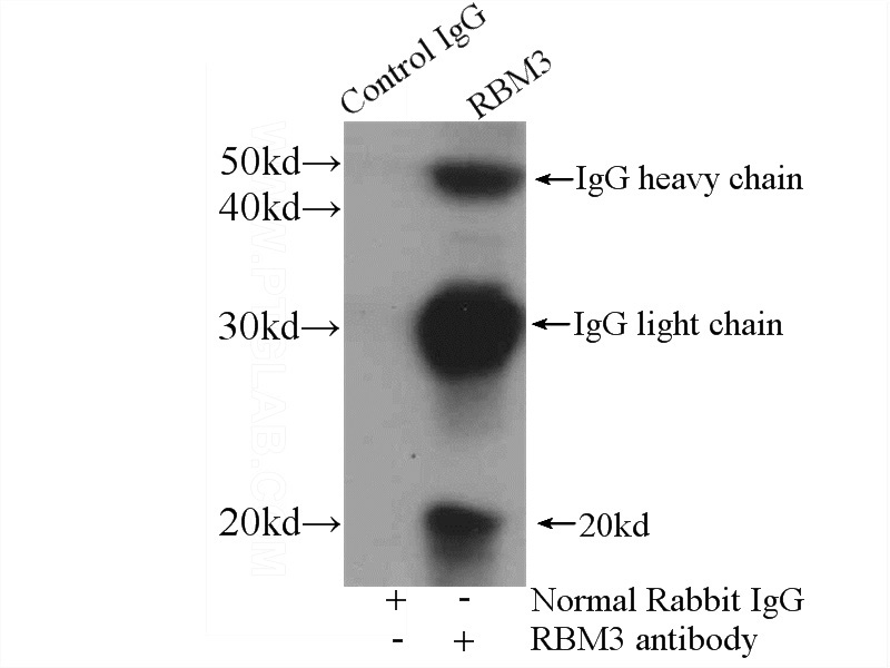 IP Result of anti-RBM3 (IP:Catalog No:114610, 4ug; Detection:Catalog No:114610 1:300) with MCF-7 cells lysate 3200ug.