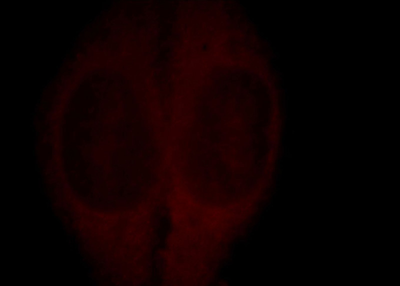 Immunofluorescent analysis of HepG2 cells, using KIF19 antibody Catalog No:112003 at 1:25 dilution and Rhodamine-labeled goat anti-rabbit IgG (red).