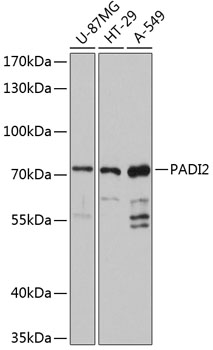 Western blot - PADI2 Polyclonal Antibody 