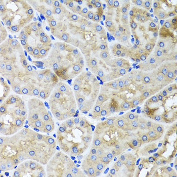 Immunohistochemistry - USH1C Polyclonal Antibody 