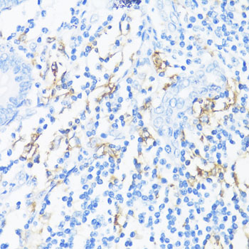 Immunohistochemistry - HLA-DRB3 Polyclonal Antibody 