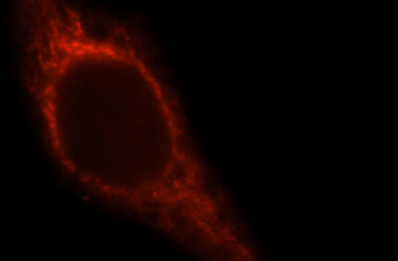 Immunofluorescent analysis of Hela cells, using MAP2K5 antibody Catalog No:112647 at 1:25 dilution and Rhodamine-labeled goat anti-rabbit IgG (red).