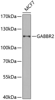 Western blot - GABBR2 Polyclonal Antibody 