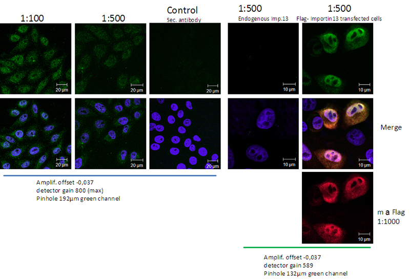IF result in Hela cell from Dr. Ralph Kehlenbach showed Nuclear and Cytoplasma stain.