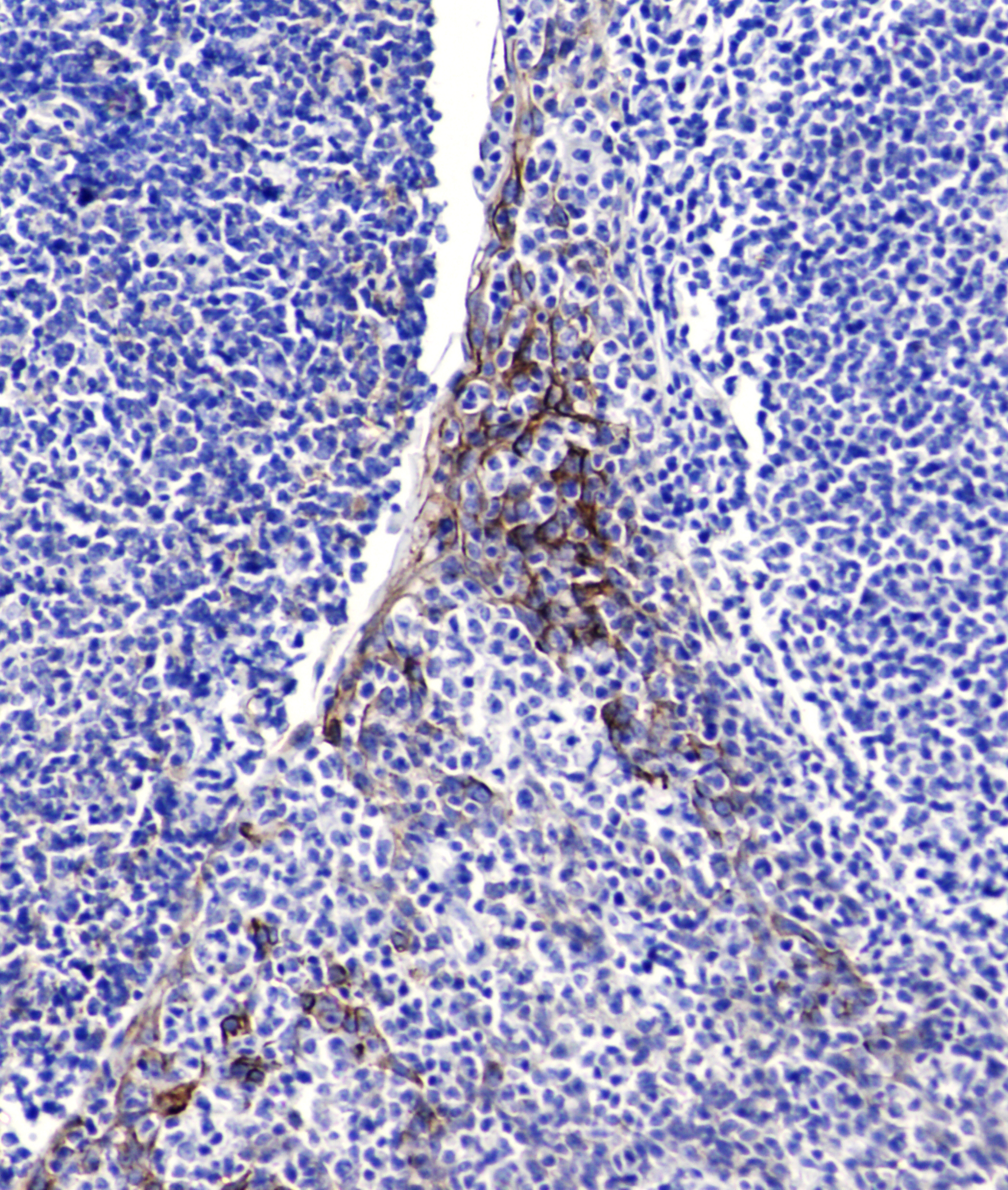 Immunohistochemical analysis of paraffin-embedded human tonsils using CD54/ICAM-1 (1C7) Mouse mAb.