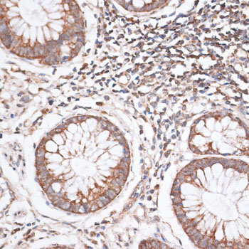 Immunohistochemistry - KIF14 Polyclonal Antibody 