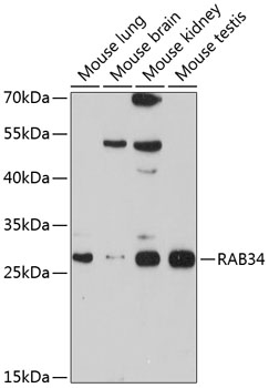 Western blot - RAB34 Polyclonal Antibody 