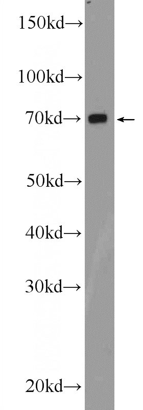 mouse liver tissue were subjected to SDS PAGE followed by western blot with Catalog No:115308(SLC19A3 Antibody) at dilution of 1:600