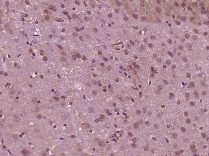 Fig1: Paraformaldehyde-fixed, paraffin embedded (Rat brain); Antigen retrieval by boiling in sodium citrate buffer (pH6.0) for 15min; Block endogenous peroxidase by 3% hydrogen peroxide for 20 minutes; Blocking buffer (normal goat serum) at 37℃ for 30min; Antibody incubation with (MED12) Polyclonal Antibody, Unconjugated at 1:400 overnight at 4℃, followed by operating according to SP Kit(Rabbit) (sp-0023) instructionsand DAB staining.