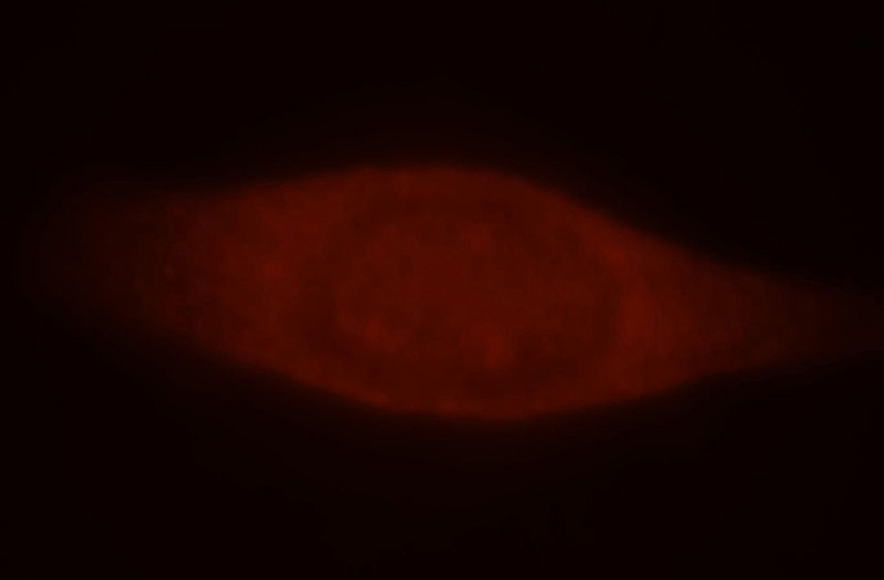 Immunofluorescent analysis of MCF-7 cells, using PRKAA2 antibody Catalog No:108007 at 1:25 dilution and Rhodamine-labeled goat anti-rabbit IgG (red).