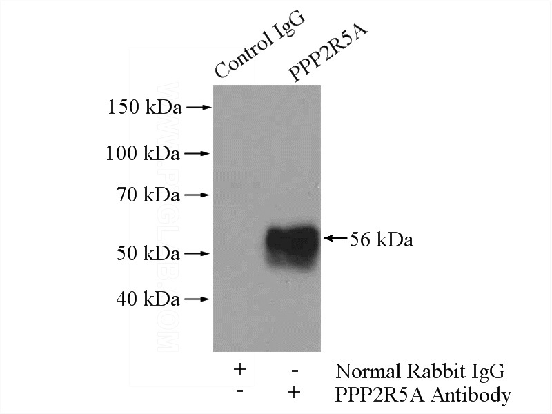 IP Result of anti-PPP2R5A (IP:Catalog No:114105, 4ug; Detection:Catalog No:114105 1:500) with mouse brain tissue lysate 4000ug.