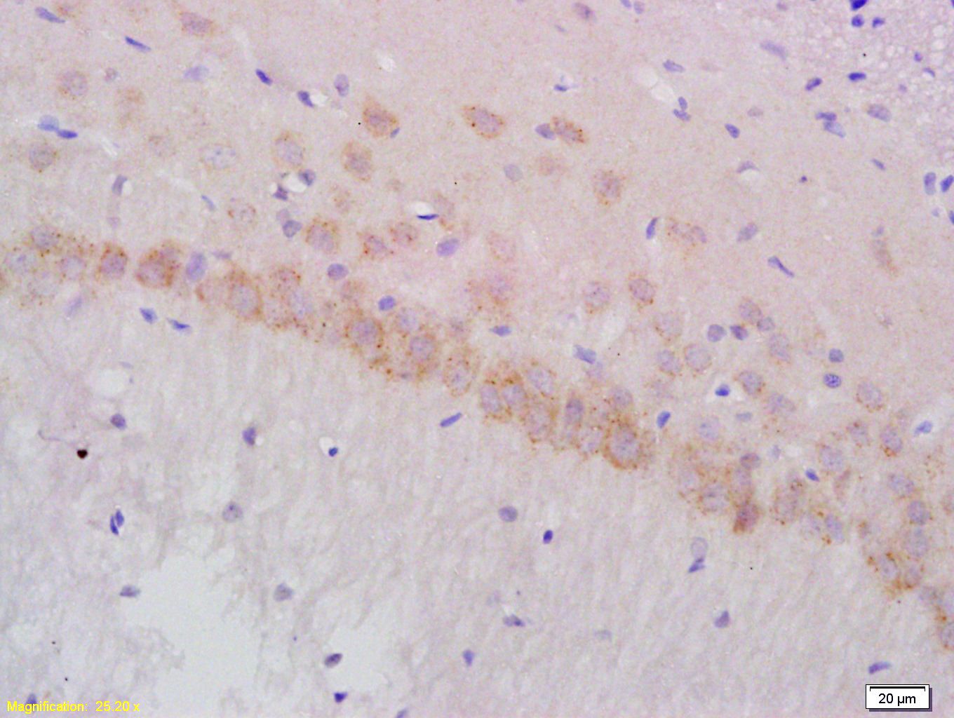 Fig3: Tissue/cell: rat brain tissue; 4% Paraformaldehyde-fixed and paraffin-embedded;; Antigen retrieval: citrate buffer ( 0.01M, pH 6.0 ), Boiling bathing for 15min; Block endogenous peroxidase by 3% Hydrogen peroxide for 30min; Blocking buffer (normal goat serum,C-0005) at 37℃ for 20 min;; Incubation: Anti-Gamma-Adaptin Polyclonal Antibody, Unconjugated 1:200, overnight at 4℃, followed by conjugation to the secondary antibody(SP-0023) and DAB(C-0010) staining