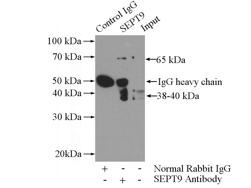 IP Result of anti-SEPT9 (IP:Catalog No:115123, 4ug; Detection:Catalog No:115123 1:1000) with mouse brain tissue lysate 4000ug.