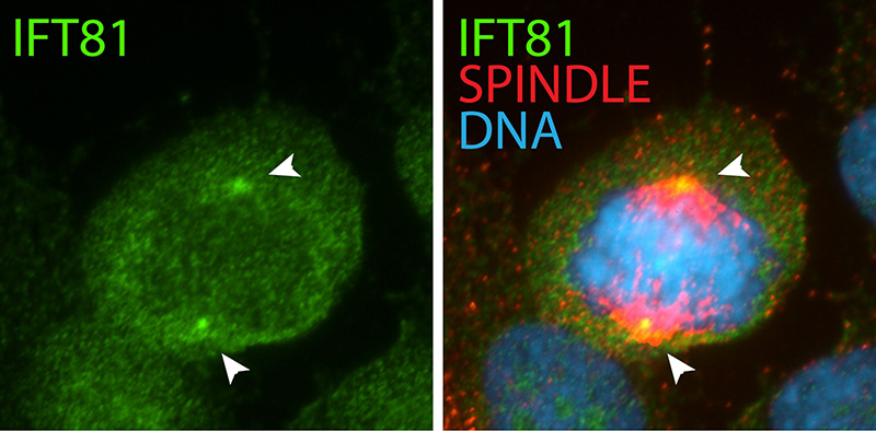 IF result (localization to the spindle poles) of anti-IFT81 (Catalog No:111673, 1:50) with metaphase hTERT-RPE1 cells (MeOH fixed) byDr. Moshe Kim.