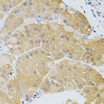 Immunohistochemistry - SYK Polyclonal Antibody 