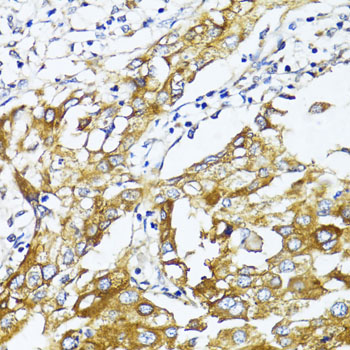 Immunohistochemistry - GLUT4 Polyclonal Antibody 