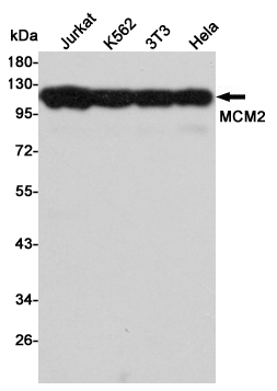 Western blot detection of MCM2 in Jurkat,K562,3T3 and Hela cell lysates using MCM2 mouse mAb (1:3000 diluted).Predicted band size:125KDa.Observed band size:125KDa.