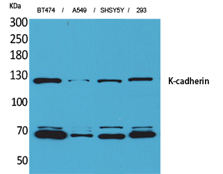 Fig1:; Western Blot analysis of BT474, A549, SHSY5Y, 293 cells using K-cadherin Polyclonal Antibody.. Secondary antibody（catalog#: HA1001) was diluted at 1:20000