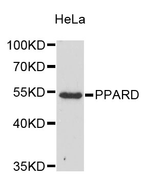 Western blot - KLF17 Polyclonal Antibody 