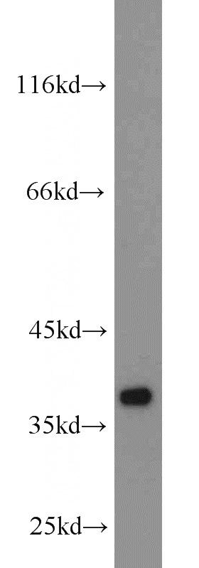 mouse heart tissue were subjected to SDS PAGE followed by western blot with Catalog No:108905(CNN1 antibody) at dilution of 1:1000