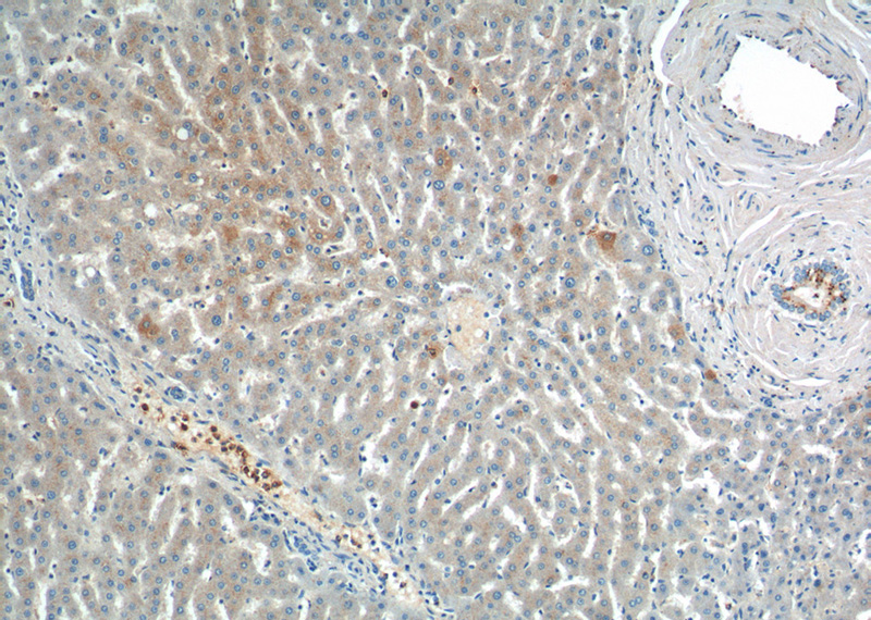 Immunohistochemistry of paraffin-embedded human liver tissue slide using Catalog No:111676(IGF1A-Specific Antibody) at dilution of 1:200 (under 10x lens).