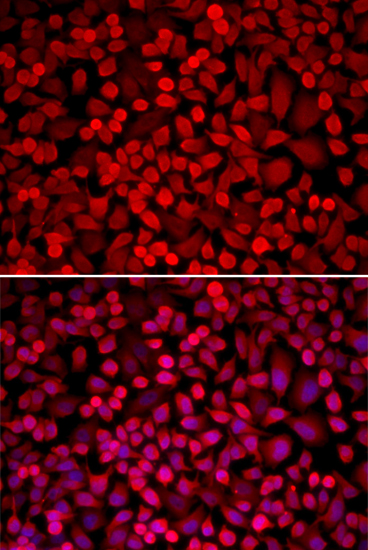 Immunofluorescence - NCOA1 Polyclonal Antibody 