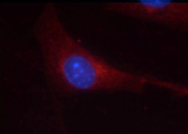 Immunofluorescent analysis of NIH/3T3 cells using Catalog No:111171(GSK3B Antibody) at dilution of 1:25 and Rhodamine-Goat anti-Rabbit IgG