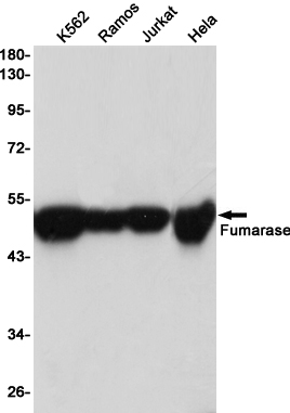 Western blot detection of Fumarase in K562,Ramos,Jurkat,Hela cell lysates using Fumarase (2A3) Mouse mAb(1:1000 diluted).Predicted band size:50KDa.Observed band size:50KDa.