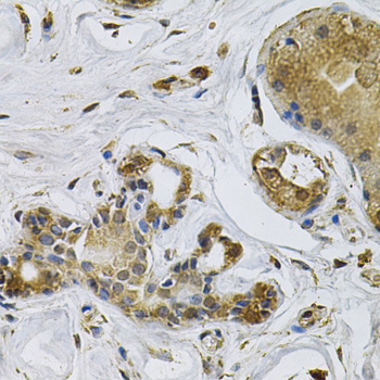 Immunohistochemistry - NCF4 Polyclonal Antibody 