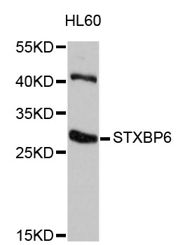 Western blot - STXBP6 Polyclonal Antibody 