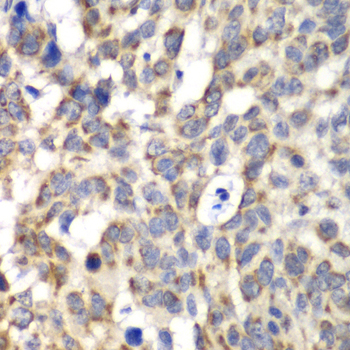 Immunohistochemistry - PARN Polyclonal Antibody 