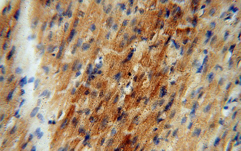 Immunohistochemical of paraffin-embedded human heart using Catalog No:114568(RBX1 antibody) at dilution of 1:50 (under 40x lens)