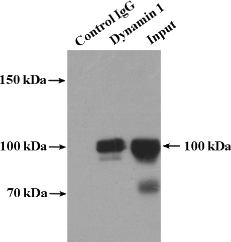 IP Result of anti-DNM1 (IP:Catalog No:110129, 4ug; Detection:Catalog No:110129 1:2000) with mouse brain tissue lysate 4000ug.