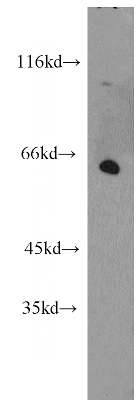 HepG2 cells were subjected to SDS PAGE followed by western blot with Catalog No:111944(ISYNA1 antibody) at dilution of 1:400