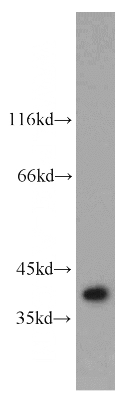 mouse thymus tissue were subjected to SDS PAGE followed by western blot with Catalog No:114918(RQCD1 antibody) at dilution of 1:1000