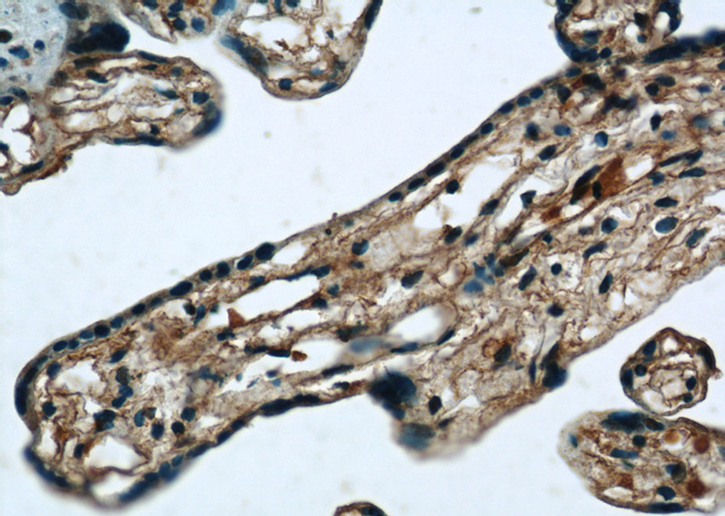 Immunohistochemistry of paraffin-embedded human placenta tissue slide using Catalog No:116409(TRPC6 Antibody) at dilution of 1:50 (under 40x lens)