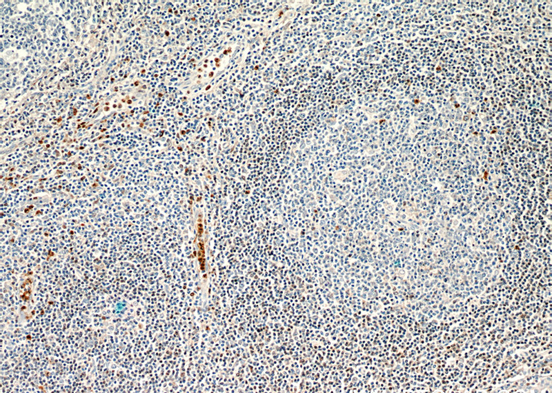 Immunohistochemistry of paraffin-embedded human tonsillitis slide using Catalog No:111157(GCA Antibody) at dilution of 1:50