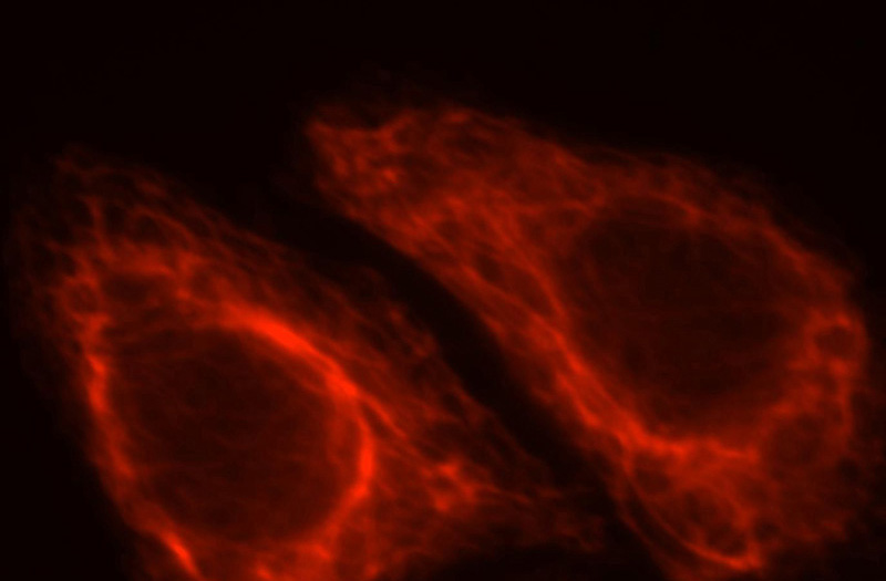 Immunofluorescent analysis of HepG2 cells, using PDRG1 antibody Catalog No:113636 at 1:25 dilution and Rhodamine-labeled goat anti-rabbit IgG (red).