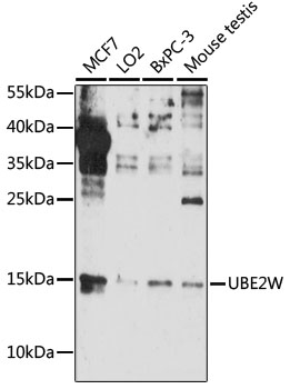 Western blot - UBE2W Polyclonal Antibody 