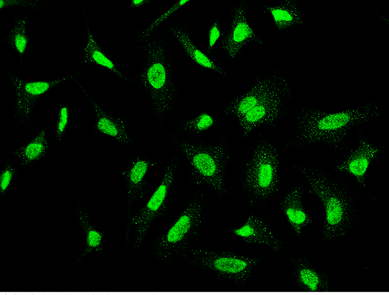 Human CSNK2A2 Immunofluorescence(IF) 15686