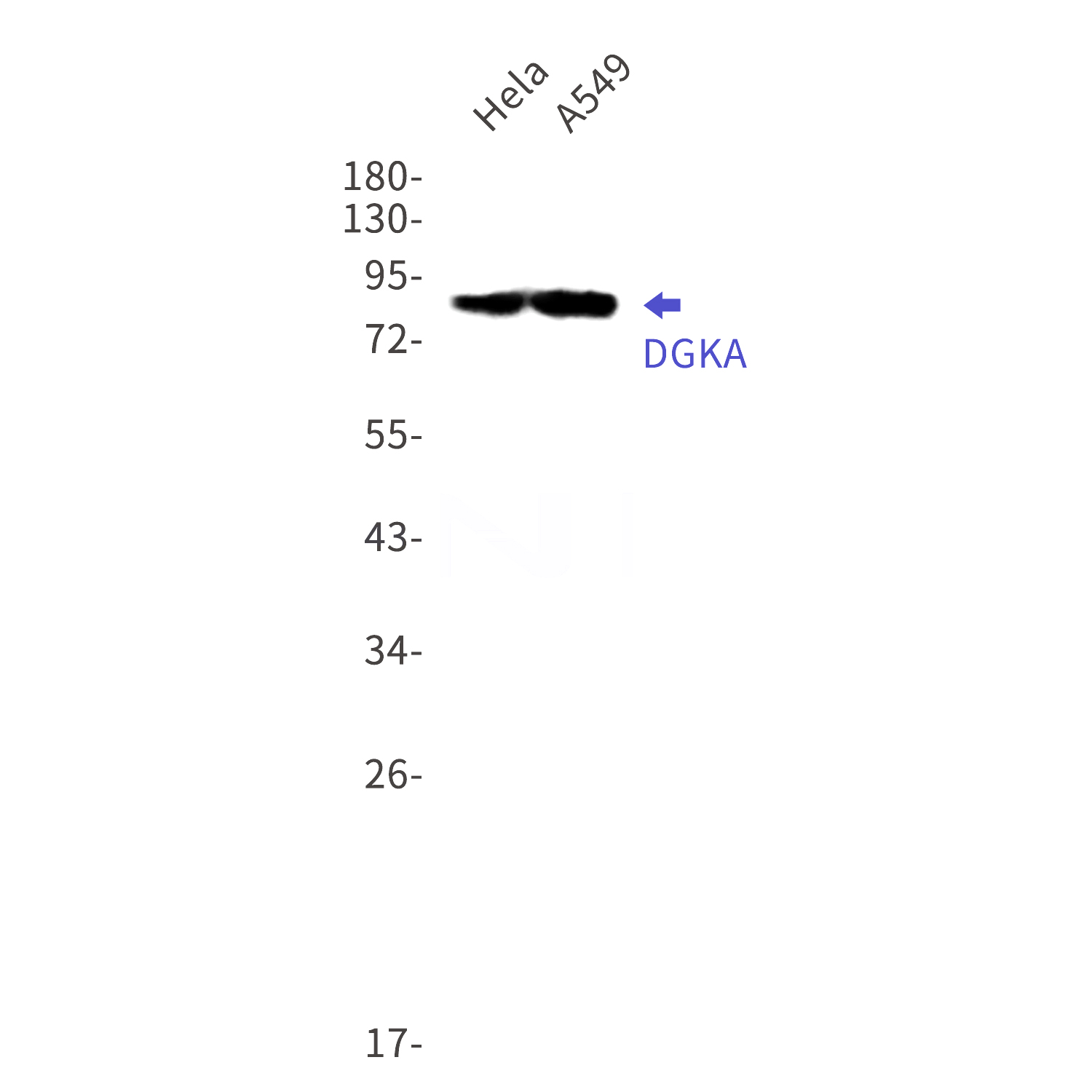 Western blot detection of DGKA in Hela,A549 cell lysates using DGKA Rabbit mAb(1:1000 diluted).Predicted band size:83kDa.Observed band size:83kDa.