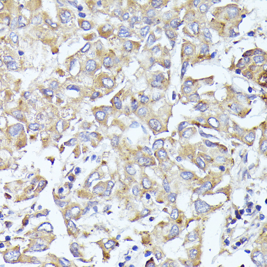 Immunohistochemistry - EIF3L Polyclonal Antibody 