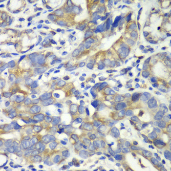 Immunohistochemistry - ABAT Polyclonal Antibody 