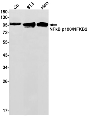 Western blot detection of NFkB p100/NFKB2 in C6,3T3,Hela cell lysates using NFkB p100/NFKB2 Rabbit mAb(1:1000 diluted).Predicted band size:97kDa.Observed band size:100kDa.