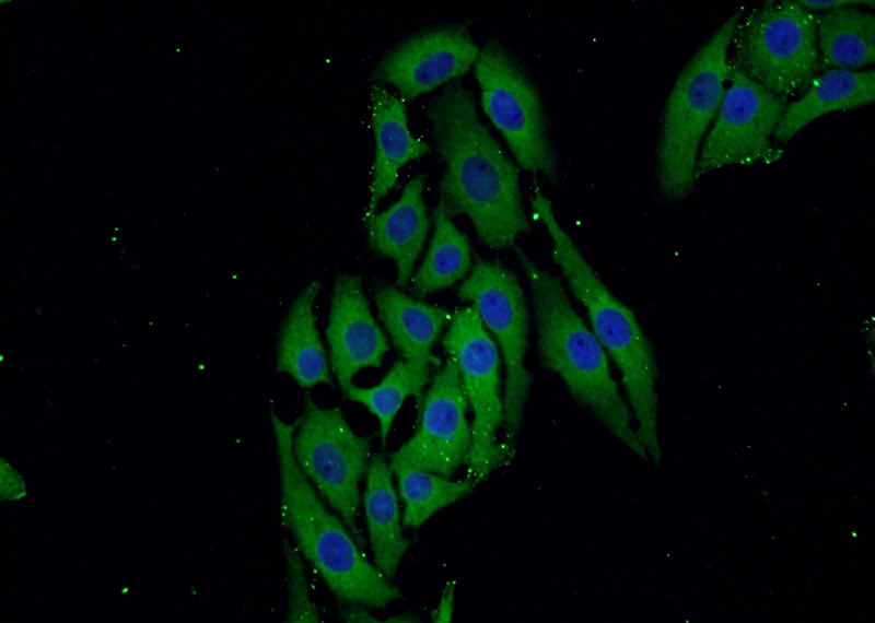 Immunofluorescent analysis of SH-SY5Y cells using Catalog No:117036(ZDHHC9 Antibody) at dilution of 1:25 and Alexa Fluor 488-congugated AffiniPure Goat Anti-Rabbit IgG(H+L)