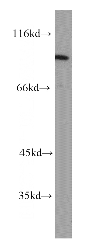 Jurkat cells were subjected to SDS PAGE followed by western blot with Catalog No:114319(PTPN22 antibody) at dilution of 1:600