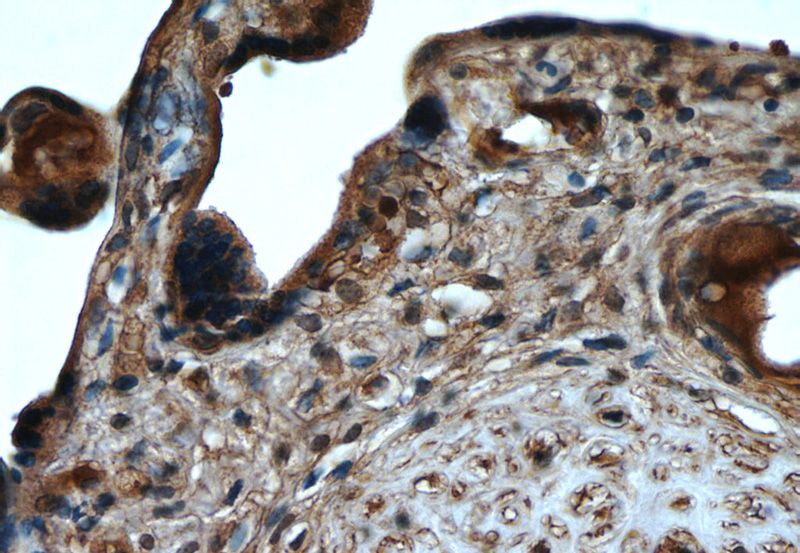 Immunohistochemistry of paraffin-embedded human placenta tissue slide using Catalog No:107479(PPARG Antibody) at dilution of 1:50 (under 40x lens)